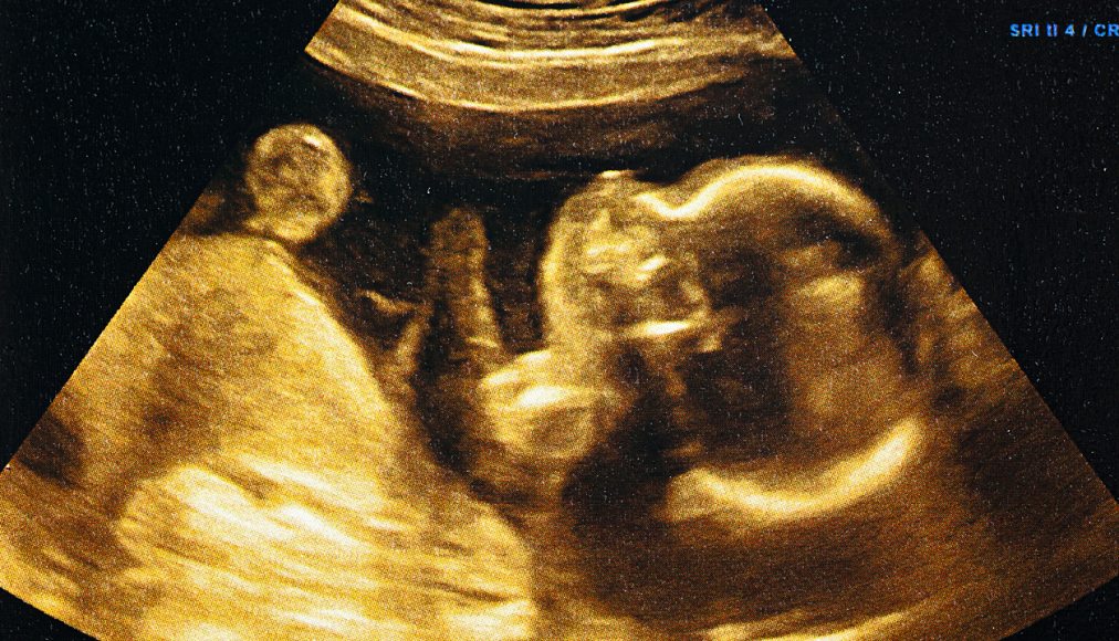 Don de sperme, mère porteuse, droit à l’enfant et droit du co-géniteur: autant de questions qui font débat Don de sperme, mère porteuse, droit à l’enfant et droit du co-géniteur: autant de questions qui font débat / IStock